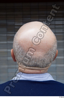 Street  664 bald hair head 0002.jpg
